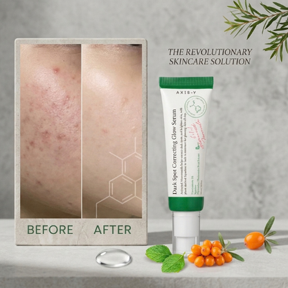 AXIS-Y Dark Spot Correcting Glow Serum – Brightening & Acne Mark Treatment